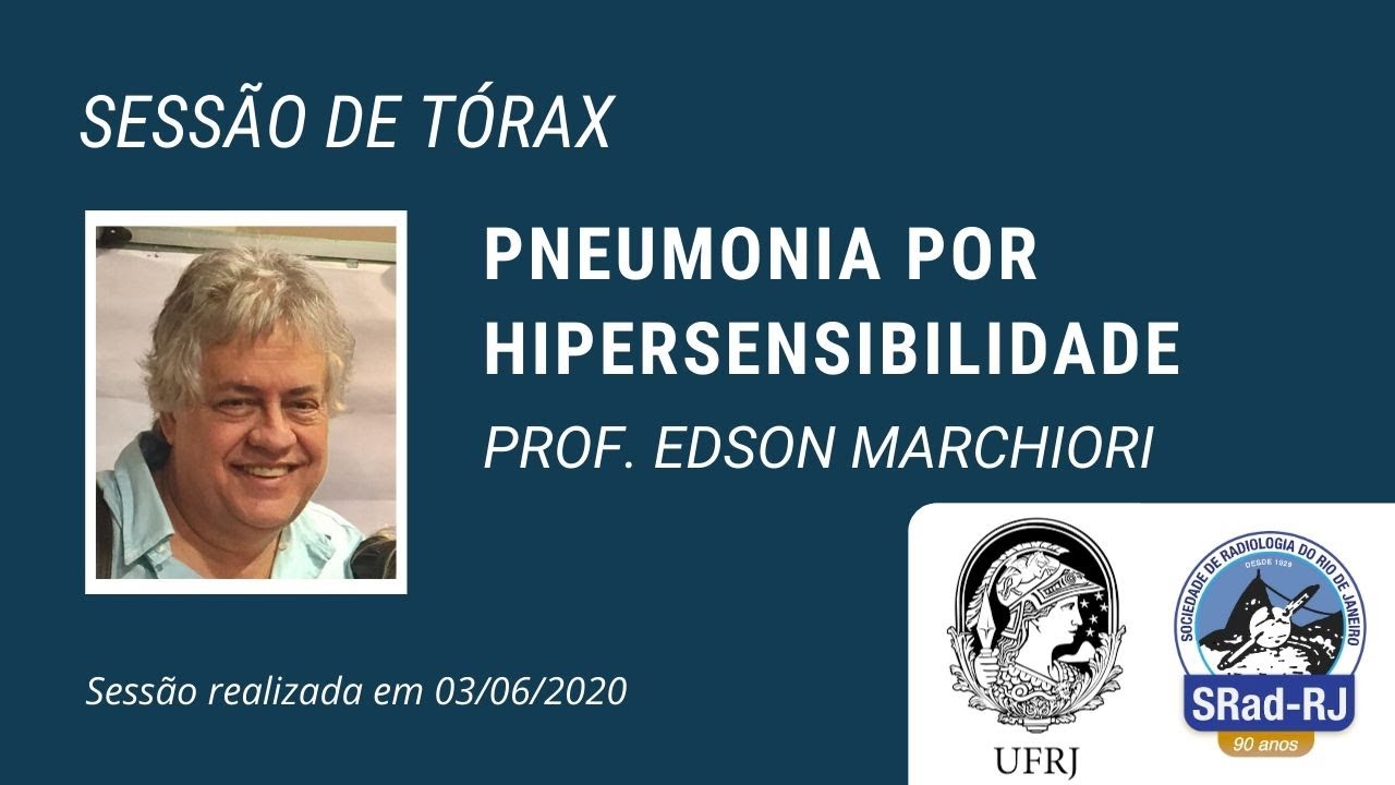 Aula 7 - 2020 -  Pneumonia por Hipersensibilidade