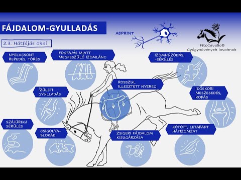 Gyulladás a hüvelykujjban: így enyhítheti a fájdalmat