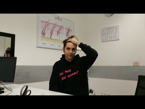 Che togliere cerchi viola sotto occhi Quale maschera fare per la persona che non ci sono state rughe