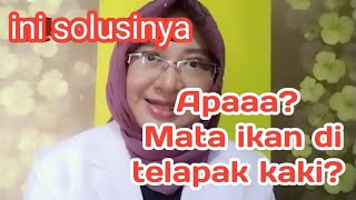 Download lagu Cara Menghilangkan Mata Ikan di Kaki mp3 Download lagu Cara Menghilangkan Mata Ikan di Kaki mp3