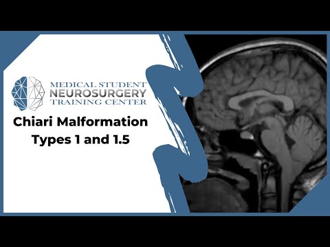 Chiari Malformation Types 1 and 1.5