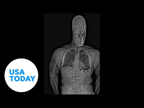 Florida thief ingests over $700,000 worth of jewels | USA TODAY