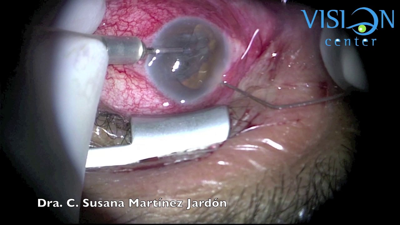 C. Susana Martinez Jardon-17