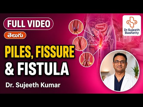 Piles, Fissure and Fistula Explained