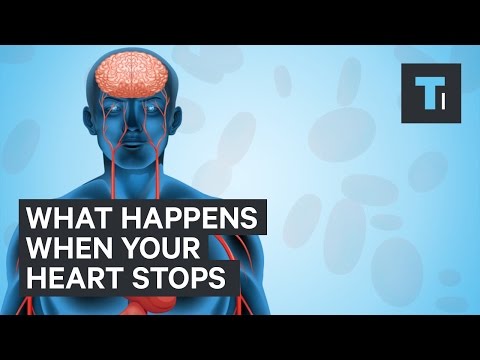 What happens when your heart stops
