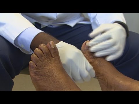 Lotseril Offline Ay nakukuha kung ang stop fungus
