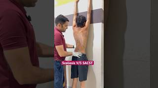 Download lagu Best Scoliosis Exercise By DrRavi #reels #scoliosis #kyphosis #chiropractic #shorts #doctor #schroth mp3 Download lagu Best Scoliosis Exercise By DrRavi #reels #scoliosis #kyphosis #chiropractic #shorts #doctor #schroth mp3