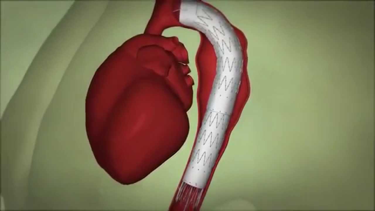 Roberto Scheibler Heck-14