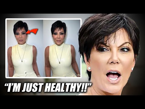 Kris Jenner CALLED OUT For Using Dangerous ‘Skinny Pills’?!