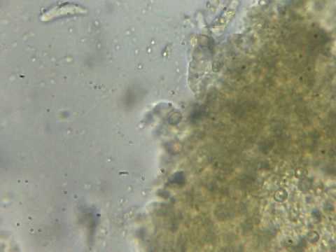Esercizi sulla schiena la cinghia lombare osteocondrosi Spalla fisioterapia congiunta