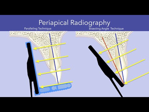 Obrazowanie wewnątrzustne w radiologii stomatologicznej