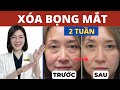 Massage 3 Phút Mỗi Ngày XÓA BỌNG MẮT Sau 2 TUẦN Thạc Sĩ Bác Sĩ Phương Quý