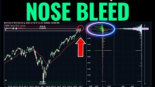 Trade Setups We're Playing At All-Time Market Highs