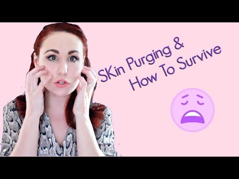 Skin Purge or Breakout? How to Survive it!!!!
