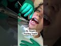 Pulling teeth to make some room #dentistry