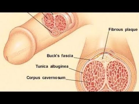 Wie die Pillen prostaplant MRT des Prostata-Adenom