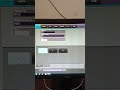 How To Enter Patient Details And Select Protocol In Fuji Cr System