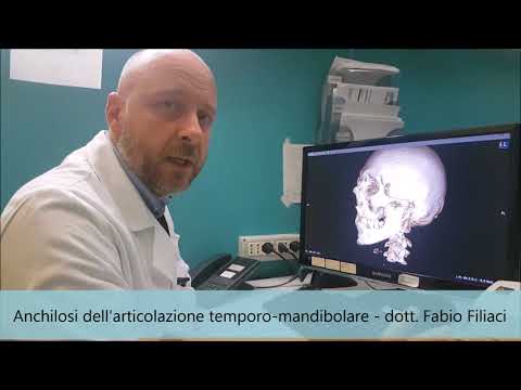 Ossificazione delle articolazioni Comprende anfibi collo separati
