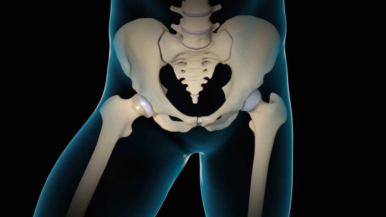 Minimally Invasive Total Hip Replacement | THR | Nucleus Health - YouTube