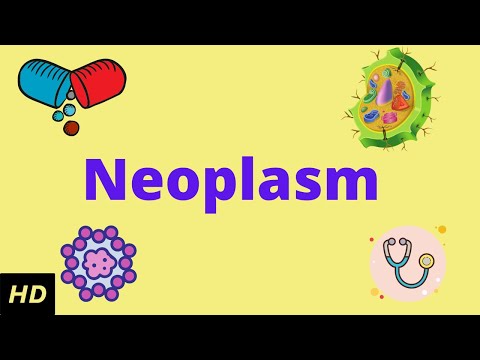 Neoplasm, Causes, Signs and Symptoms, Diagnosis and Treatment.