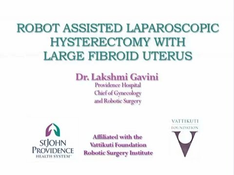 Robot Assisted Laparoscopic Hysterectomy with Large Fibroid Uterus