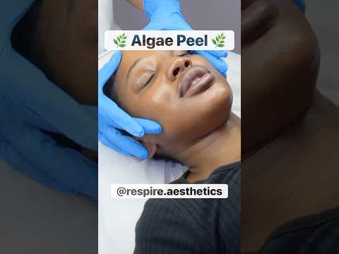 My Algae Peel Experience 🌿 | South Africa | Respire Aesthetics