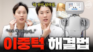 슈링크의 모든 것!