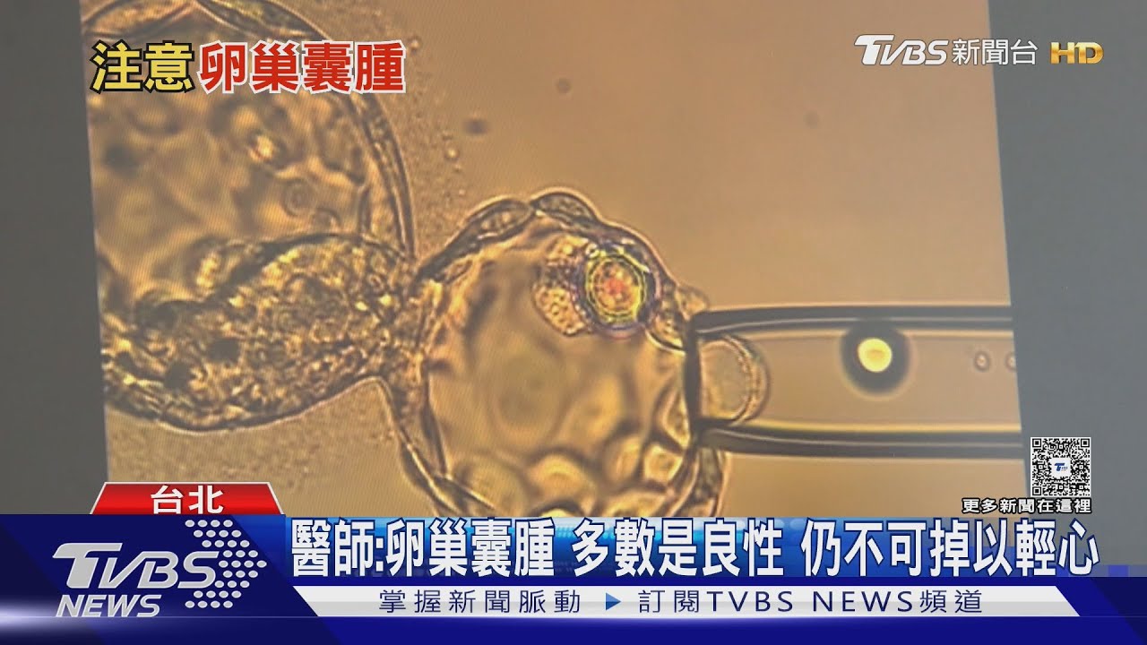 醫師揭卵巢囊腫警訊!腹脹疼痛 恐隱藏「這危機」勿輕忽!