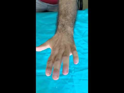 Recensioni CT dellanca Serratura per la caviglia per lo sport