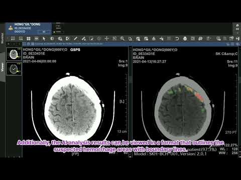 Medical Insight