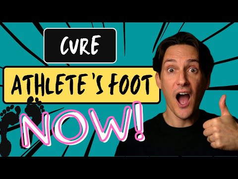 ATHLETE'S FOOT TREATMENT