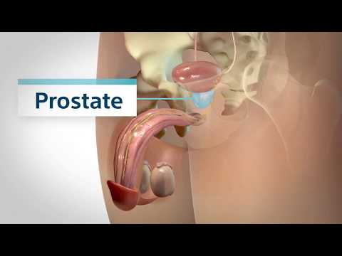 BPH i hipertenzija - U slučaju prostatitisa lijek