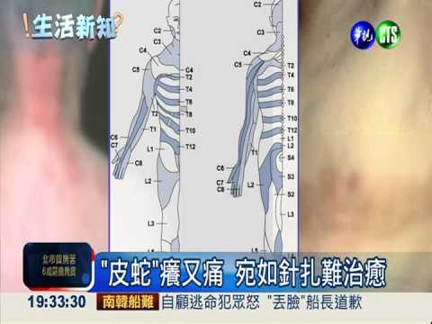 打一針免疫10年! "皮蛇"疫苗問世