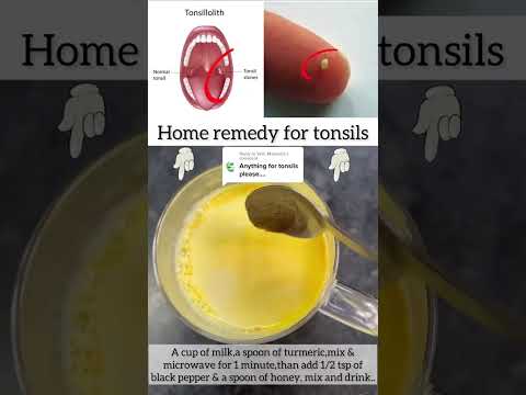 Best Remedy to Cure of Tonsilis.. #tonsilstones  #tonsils  #shorts