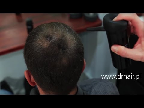 Odpowiedzi lekarz trichologist Bay niezbędna cena ropy w aptekach Hair
