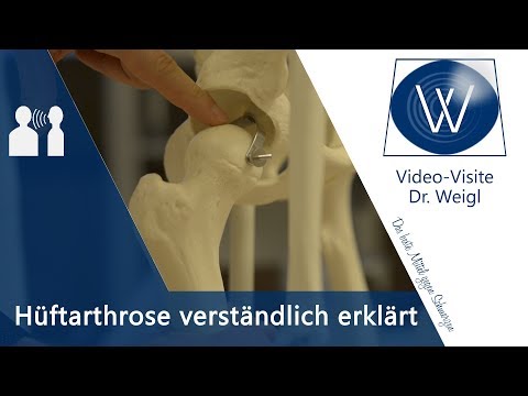 Gelenkknieschmerzen Ursachen Muttermale auf dem Rücken schmerzt