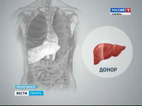 Вести. Омск. "Уникальную операцию выполнили омские врачи"