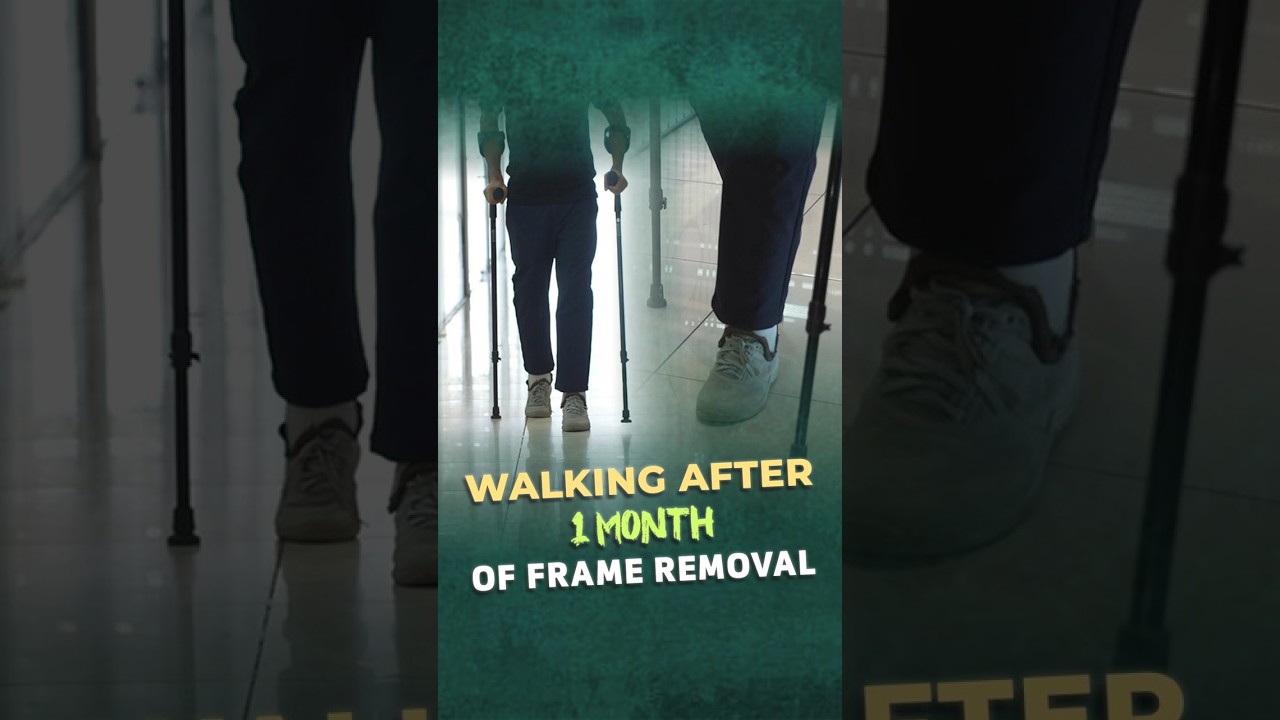 Walking 1 Month After Frame Removal | Limb Lengthening Recovery Journey | Heights Plus