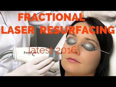 Fractional laser resurfacing- dermatologist review