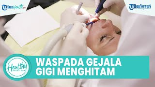 Cara Atasi Bercak Hitam pada Gigi Berlubang dengan Tindakan Fissure, Simak Ulasan drg. Munawir
