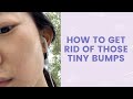 How to Get Rid of Those Tiny Bumps | FaceTory