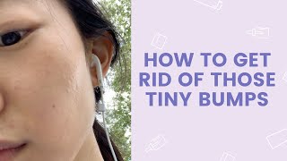 How to Get Rid of Those Tiny Bumps | FaceTory