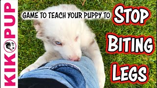 STOP biting legs - Puppy Training