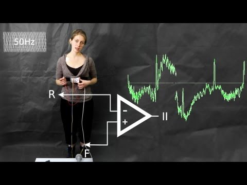 Alternating Current Interference Ecg