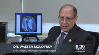 Doctors perform non-invasive brain surgery on toddler