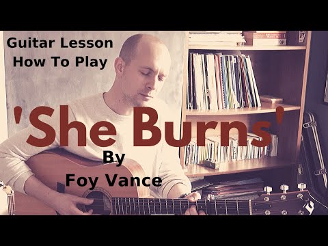 She Burns - Foy Vance
