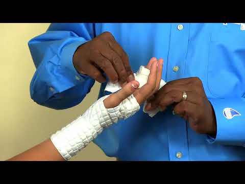 Ulna Gutter or Boxer's Cast AquaCast Application - Astir