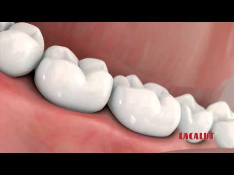 Миниатюра изображения товара Зубная паста Lacalut Basic (75мл)