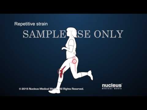 Ricetta cannella con il miele per le articolazioni Farmaci per le malattie di osteocondrosi