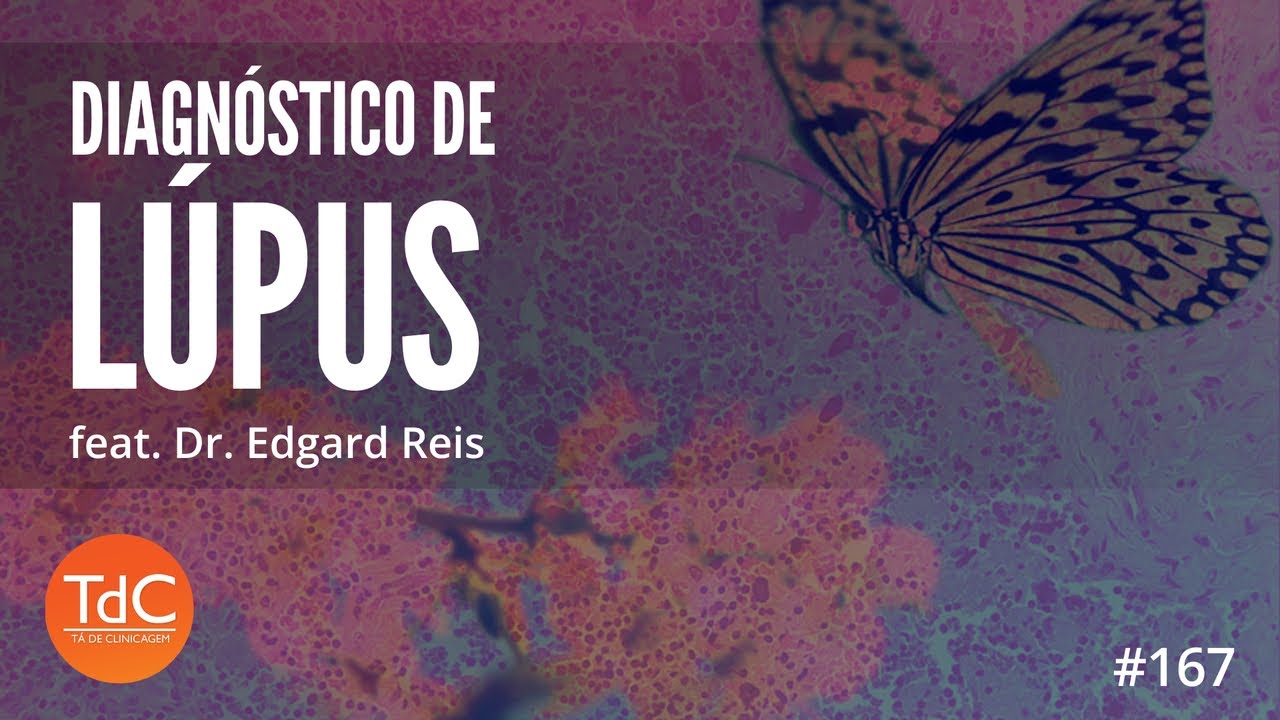 Como fazer o diagnóstico de Lupus Eritematoso Sistêmico: Episódio168